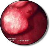 豊島園大腸肛門科