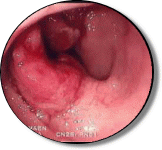 豊島園大腸肛門科
