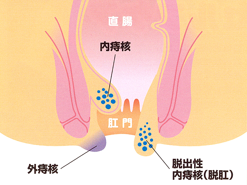 豊島園大腸肛門科
