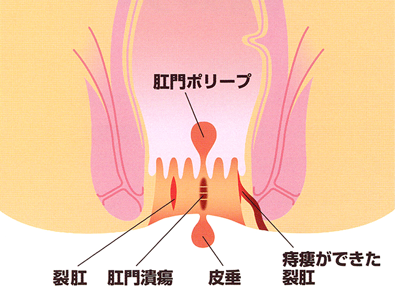 豊島園大腸肛門科