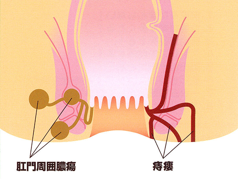 豊島園大腸肛門科